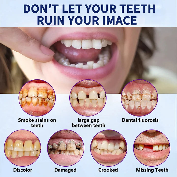 NESLEMY-š¦·Advanced Customized Full Denture Set𦷠(ā°Limited time discount last 30 minutesā°)