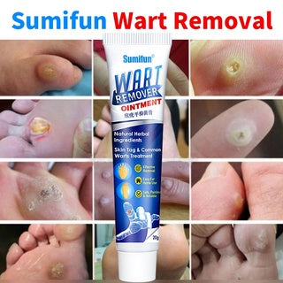 Wart Removal Ointmentă3 Day Delivery&Cash on deliveryă