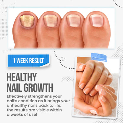 🛡️🛡️South Moon Nail Treatment Cream