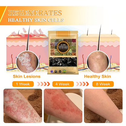 𝐀𝐧𝐧𝐢𝐞𝐂𝐚𝐫𝐞® 𝟑𝟎-𝐇𝐞𝐫𝐛 𝐒𝐥𝐢𝐦𝐦𝐢𝐧𝐠 & 𝐃𝐞𝐭𝐨𝐱 𝐅𝐨𝐨𝐭 𝐁𝐚𝐭𝐡 𝐁𝐞𝐚𝐝𝐬👩‍⚕️