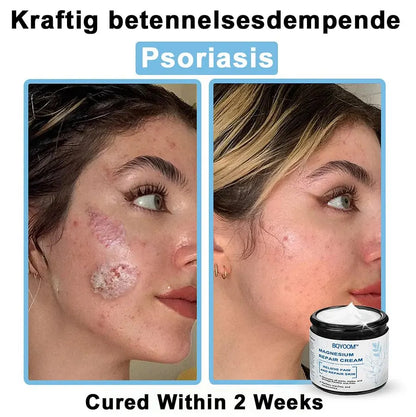 BQYOOM™ Magnesium skin repair cream👨‍⚕️NHS Approved (Psoriasis and Eczema Relief, Skin Repair, Even Tone, Acne and Dark Spot Treatment, Wart and Mole Removal)