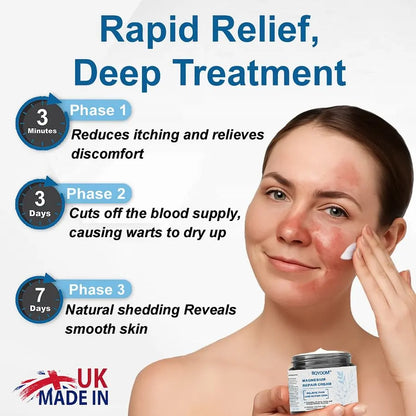 BQYOOM™ Magnesium skin repair cream👨‍⚕️NHS Approved (Psoriasis and Eczema Relief, Skin Repair, Even Tone, Acne and Dark Spot Treatment, Wart and Mole Removal)