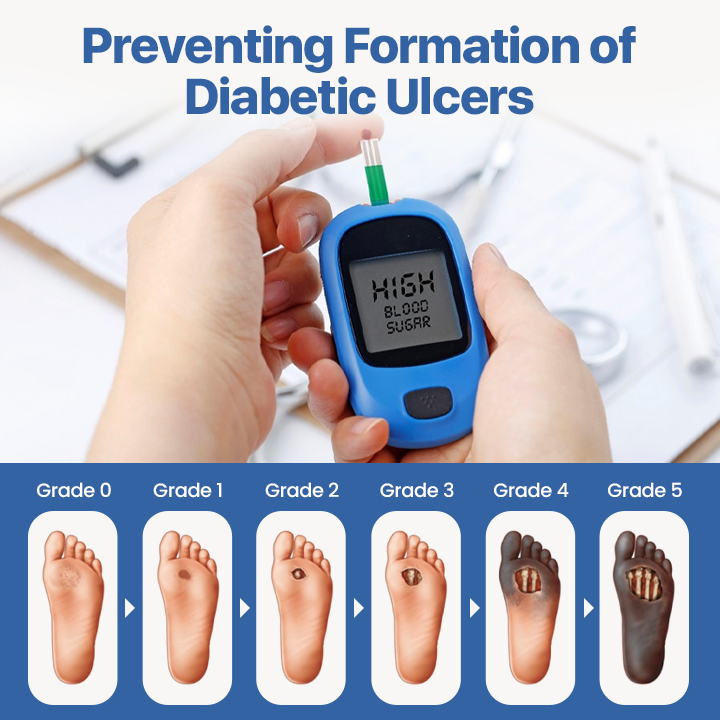 Biancat® VitaGluco Diabetes Treatment Cream🎉SPECIAL OFFER: 60% OFF This Today Only!🔥