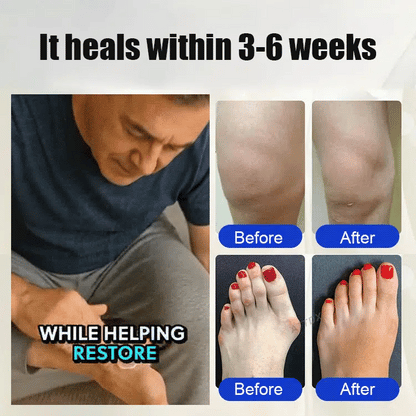 ⏳Limited-time 49% off⏰💥Czticle® Foot nerve care cream