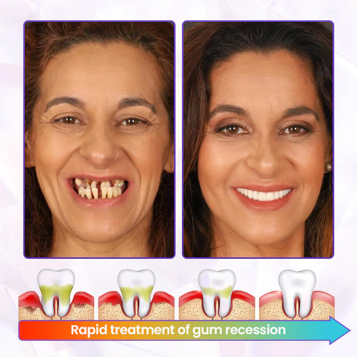 BeeRenew Advanced Gum Healing Toothpaste🎉SPECIAL OFFER: 60% OFF This Today Only!🔥