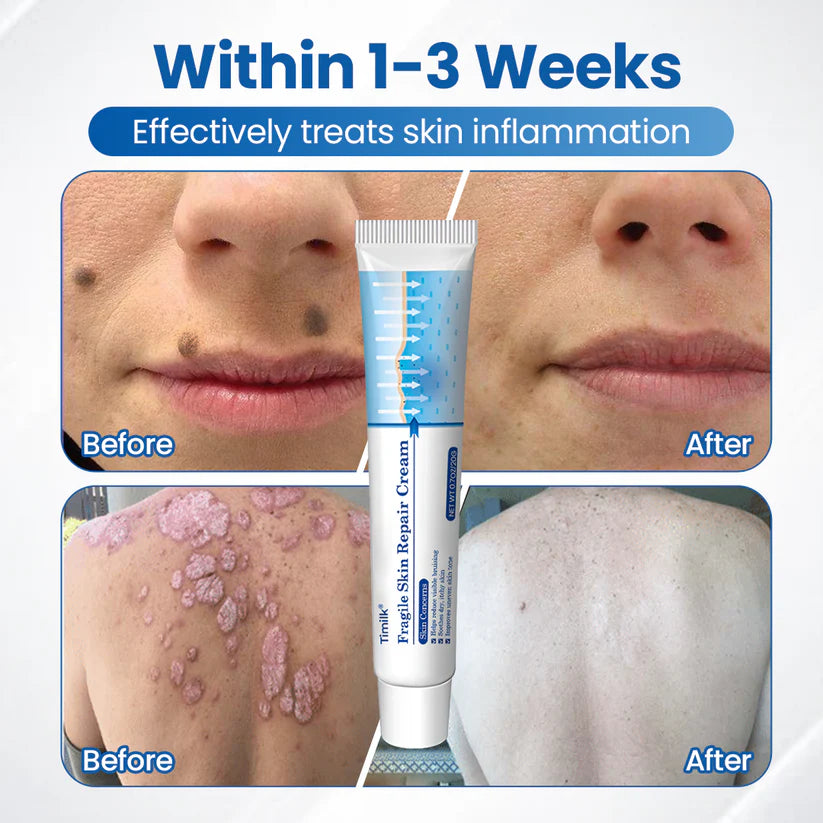 Timilk® Fragile Skin Repair Cream🎂