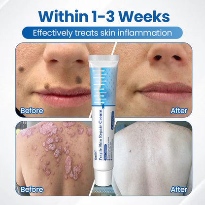Timilk® Fragile Skin Repair Cream🎂