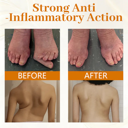 Timilk® ScorpiTakt Joint & Muscle Relief Ointment