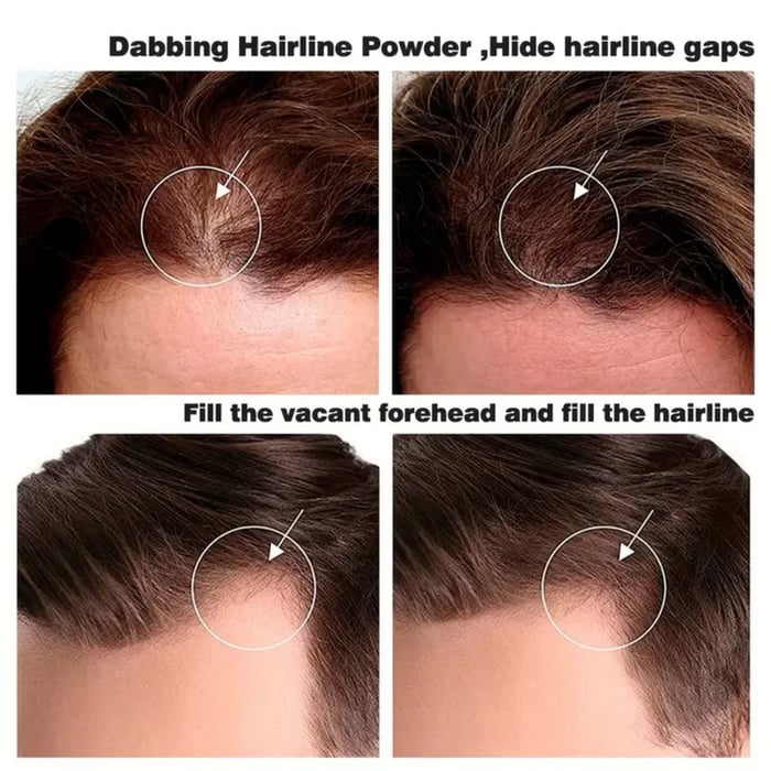 🔥Hairline contour shadow powder🔥🔥🔥