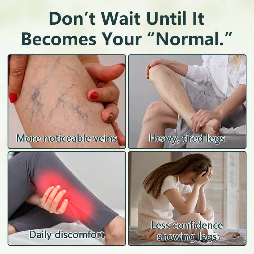 Ceoerty®VenoVelle Advanced Vein Care Oil