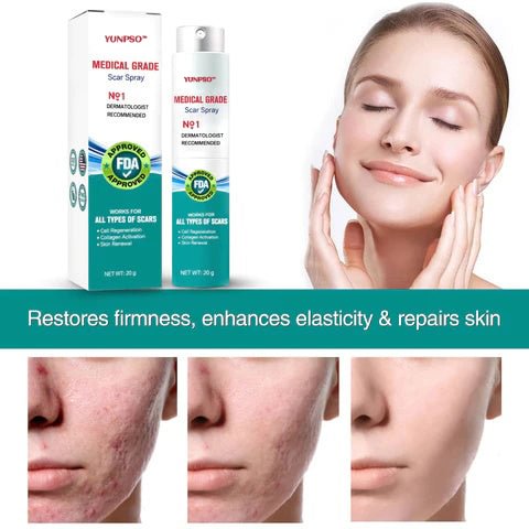 ❤️YUNPSO™ Advanced Scar Spray For All Types of Scars - For example Acne Scars, Surgical Scars and Stretch Marks
