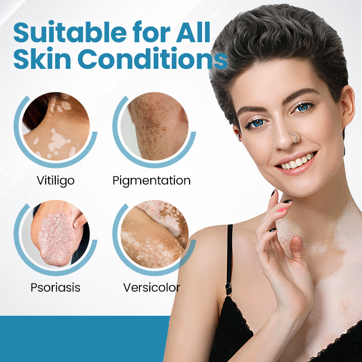 Biikenda® DermaBeam Vitiligo Therapy Device⏳Limited-time 49% off⏰💥