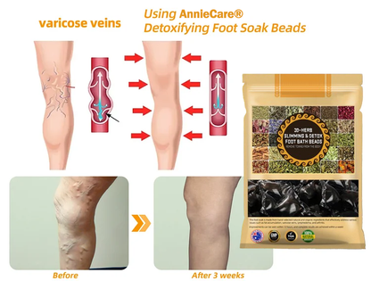 𝐀𝐧𝐧𝐢𝐞𝐂𝐚𝐫𝐞® 𝟑𝟎-𝐇𝐞𝐫𝐛 𝐒𝐥𝐢𝐦𝐦𝐢𝐧𝐠 & 𝐃𝐞𝐭𝐨𝐱 𝐅𝐨𝐨𝐭 𝐁𝐚𝐭𝐡 𝐁𝐞𝐚𝐝𝐬👩‍⚕️