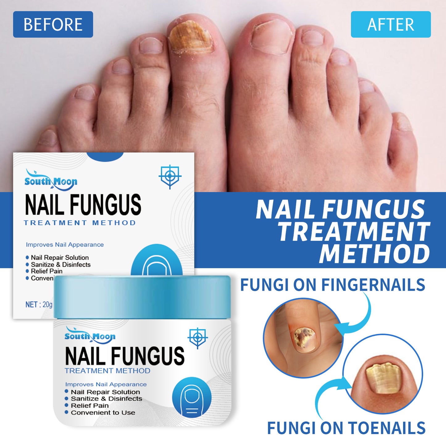 🛡️🛡️South Moon Nail Treatment Cream