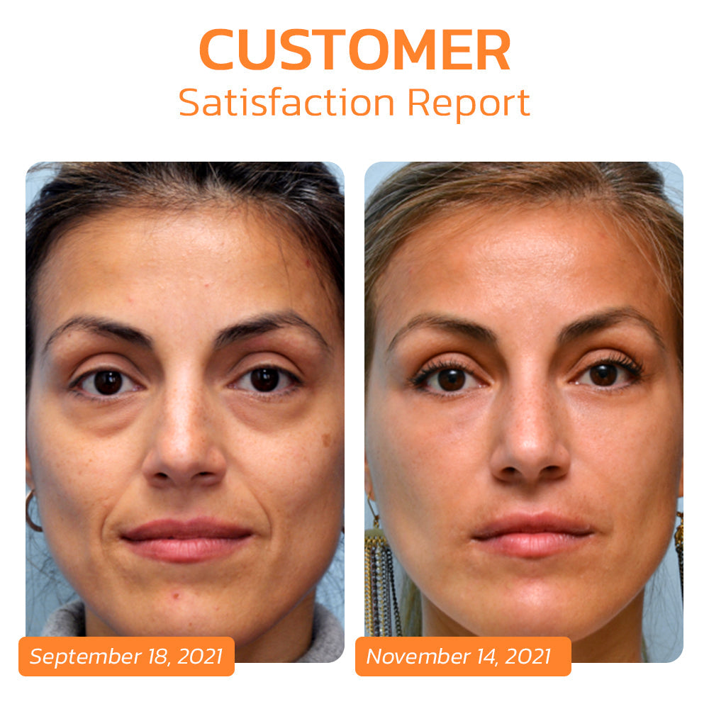 EELHOE™ Pureskin Korean Soluble Collagen Film