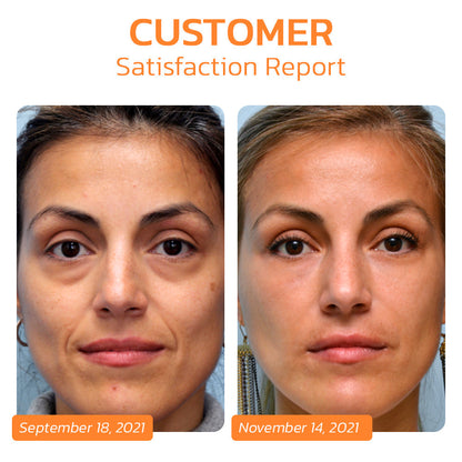 EELHOE™ Pureskin Korean Soluble Collagen Film